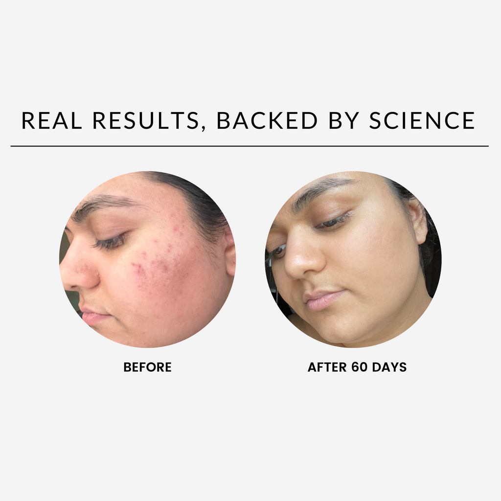 SHAYDEBEAUTY SKINCARE - THE DUO